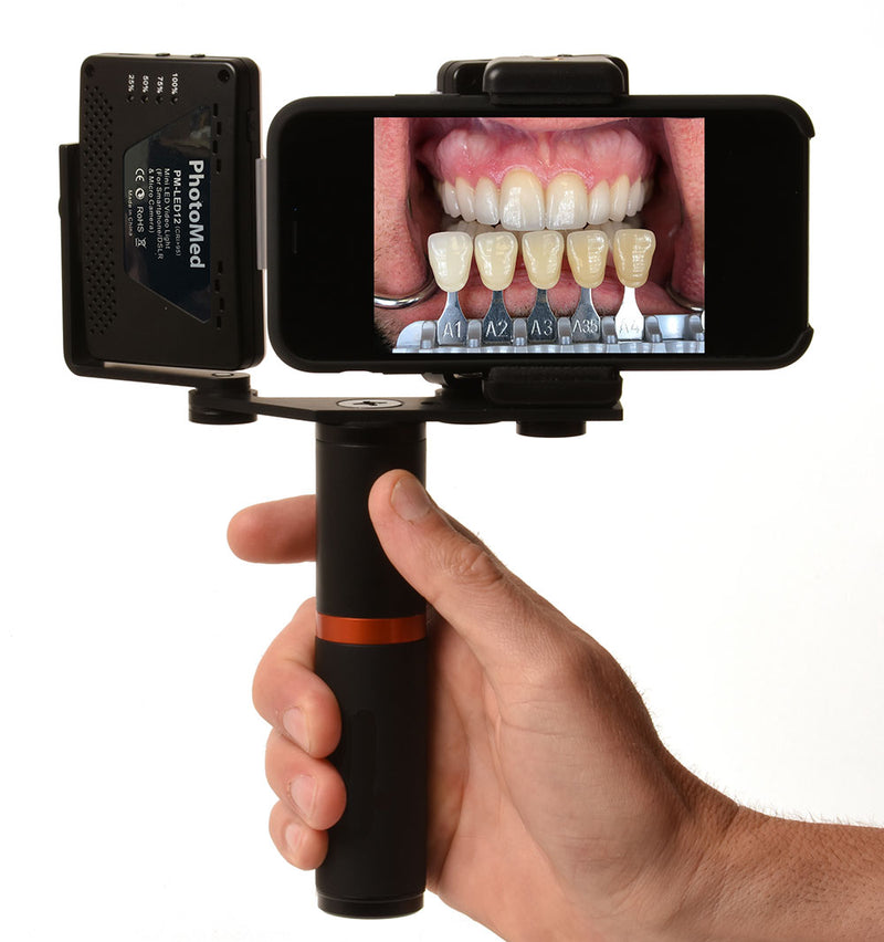 Fotografia Dental, trucos con un móvil